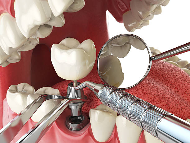 Best Orthodontic Emergency Dentist in Spanish Lake, MO